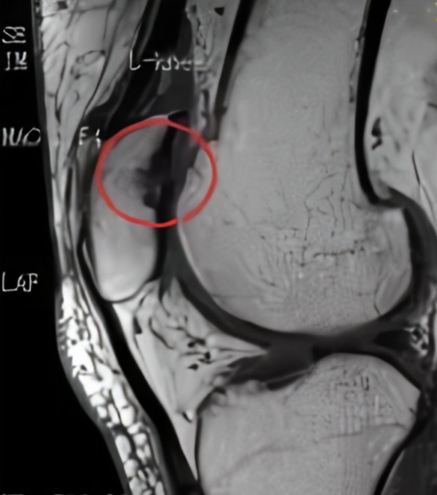 在家待久了脚痛,在家待久了胳膊关节痛