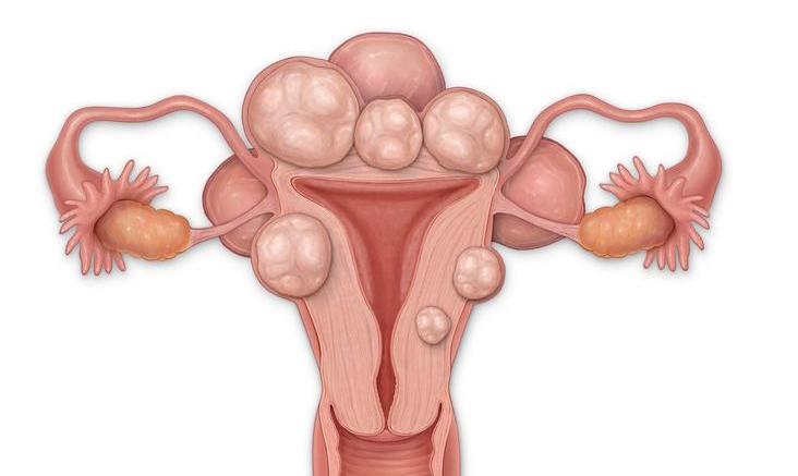 定期宫颈癌检查的目的是什么,宫颈癌定期复查的好处