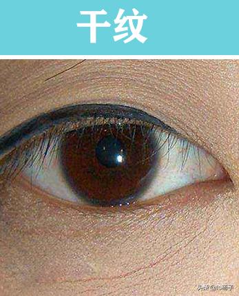 干纹细纹怎么去除最好,皱纹细纹和干纹的区别及解决方法