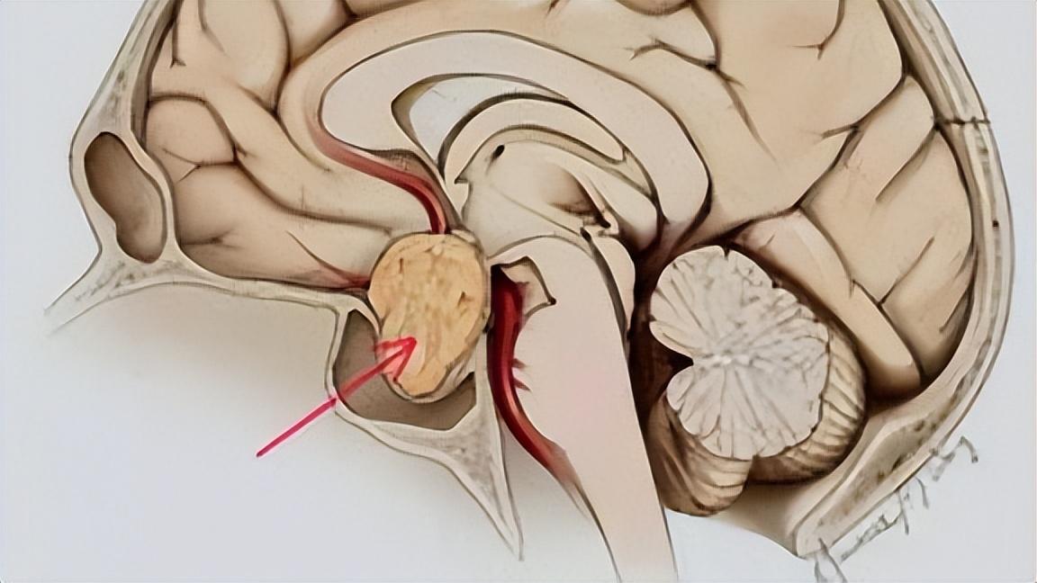 有些女性下身无毛是怎么回事？这4个原因，为了健康，最好了解