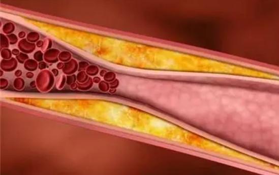 常常“手麻”的人要注意！身体或是出现了4种问题
