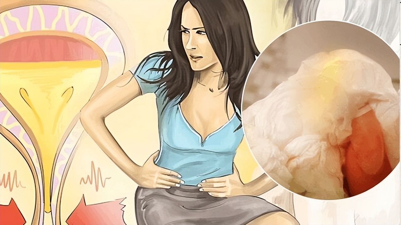 为什么女人小便后,要用纸擦一下呢?医生:很有必要