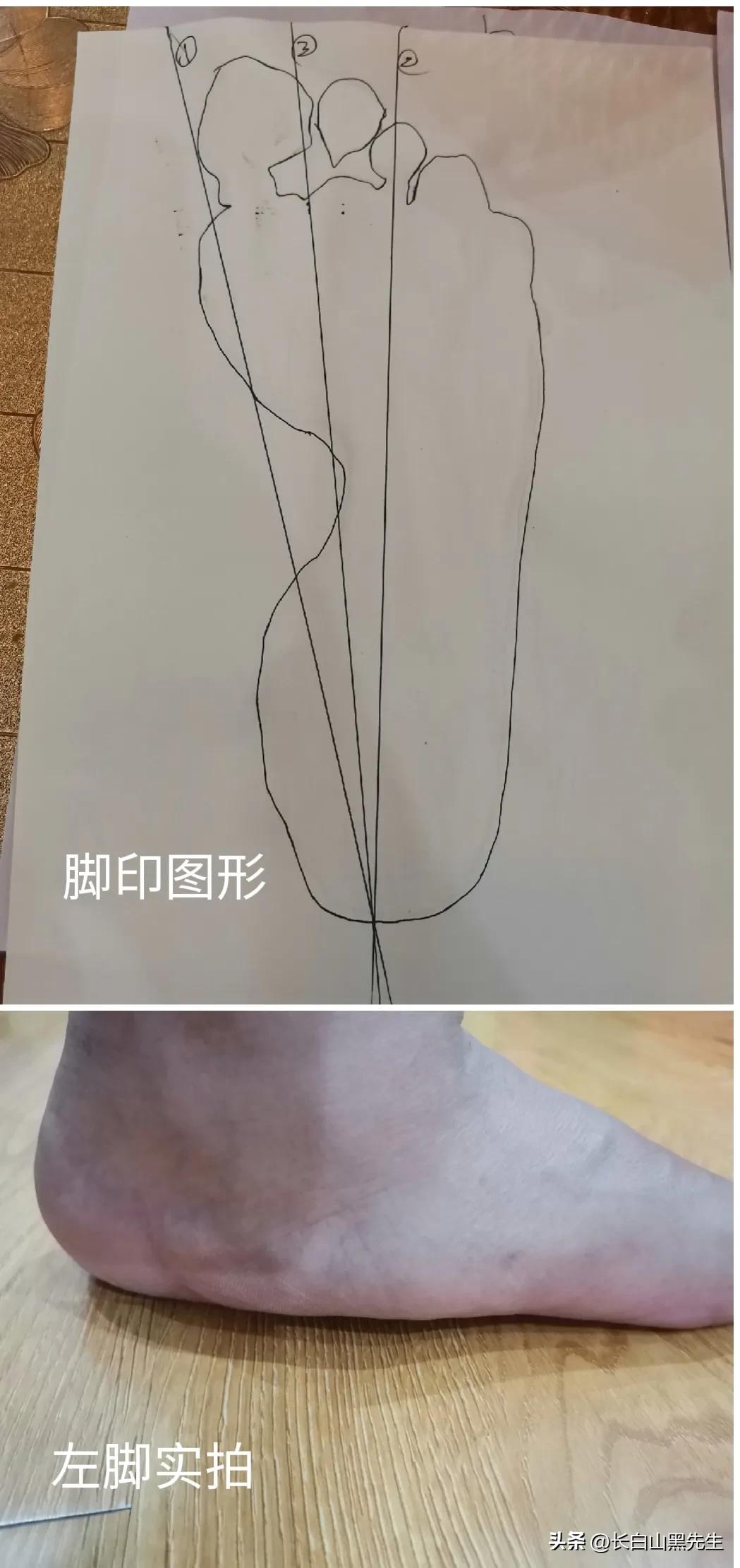 怎样跑五公里,跑步十公里怎么练半马