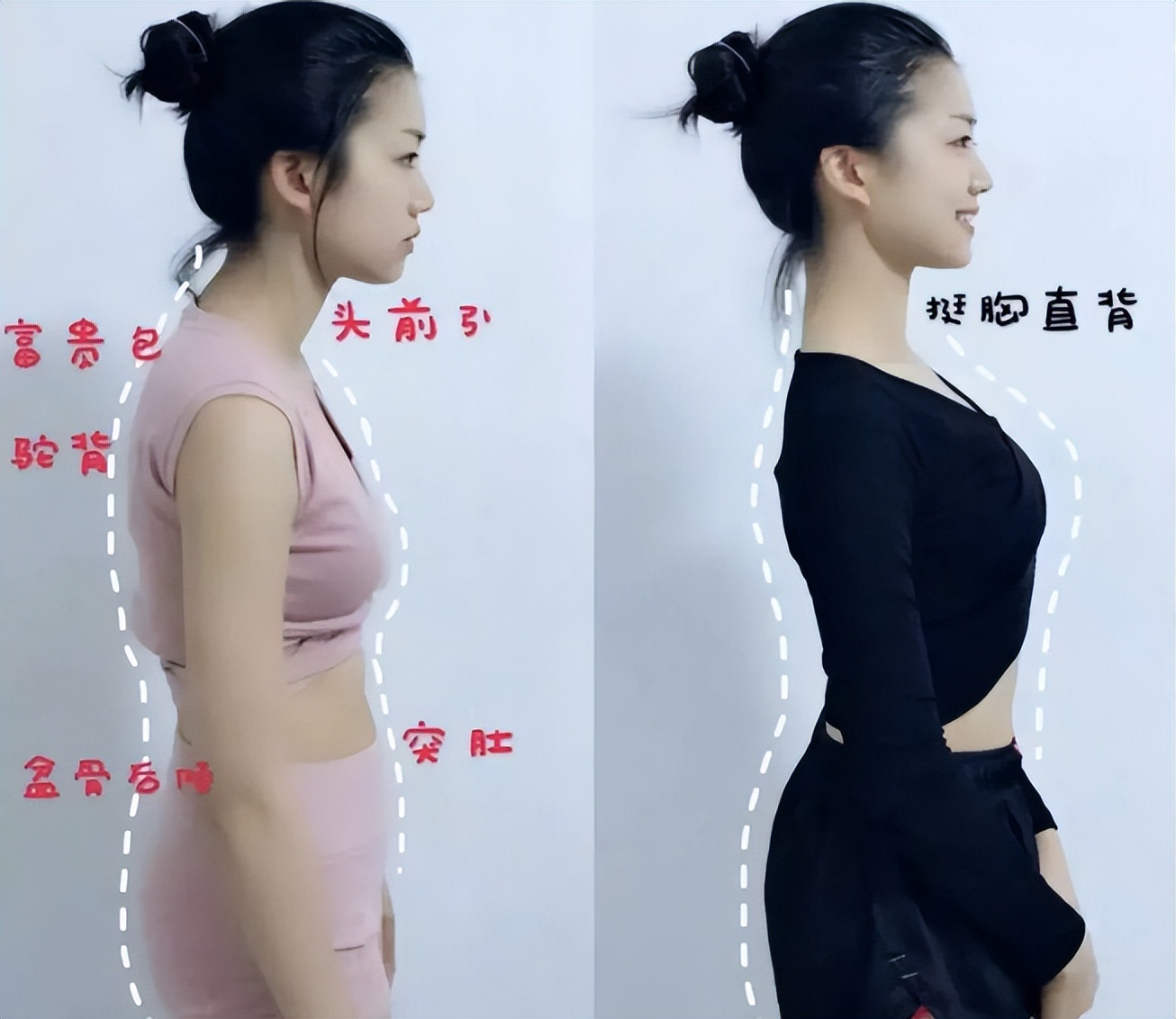 阴挺和什么有关,阴挺怎么治好得快