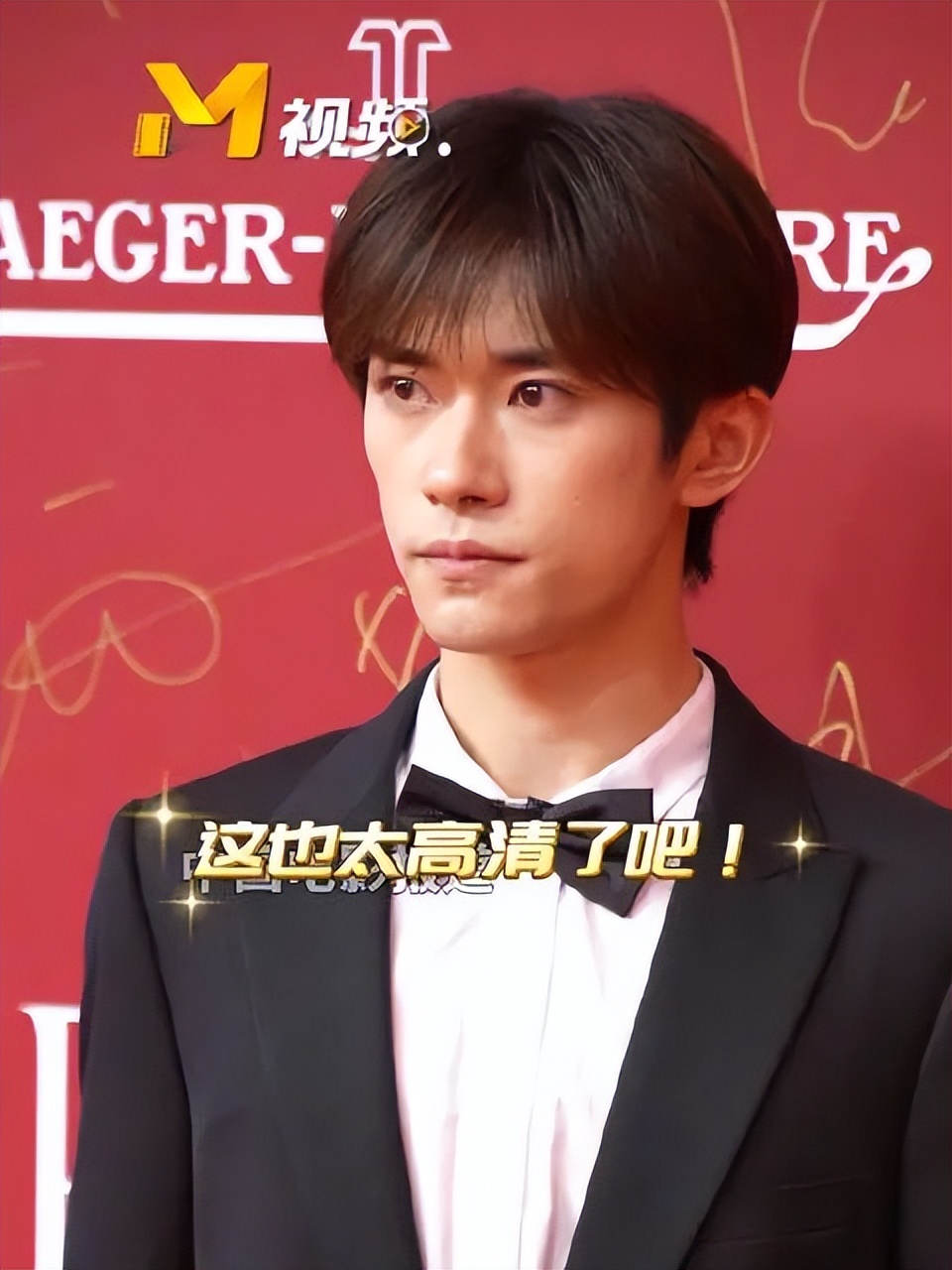 医学那么发达为什么治不了痘坑,想治痘坑但没钱怎么办