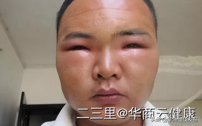 赏花的注意事项,赏花的小技巧