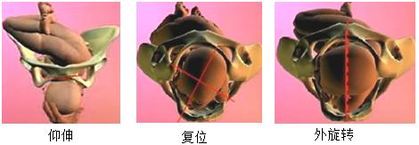胎儿屁股在右侧是什么胎位,胎位roa屁股在左边还是右边