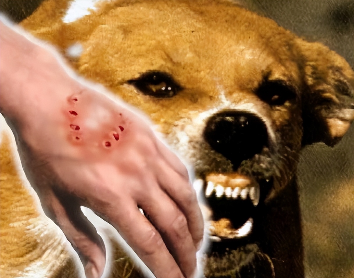 逗狗被咬索赔后续,逗狗被咬视频合集