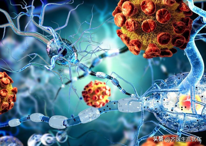 微球钇90治疗肝癌适合什么人,钇90微球能根治肝癌晚期吗