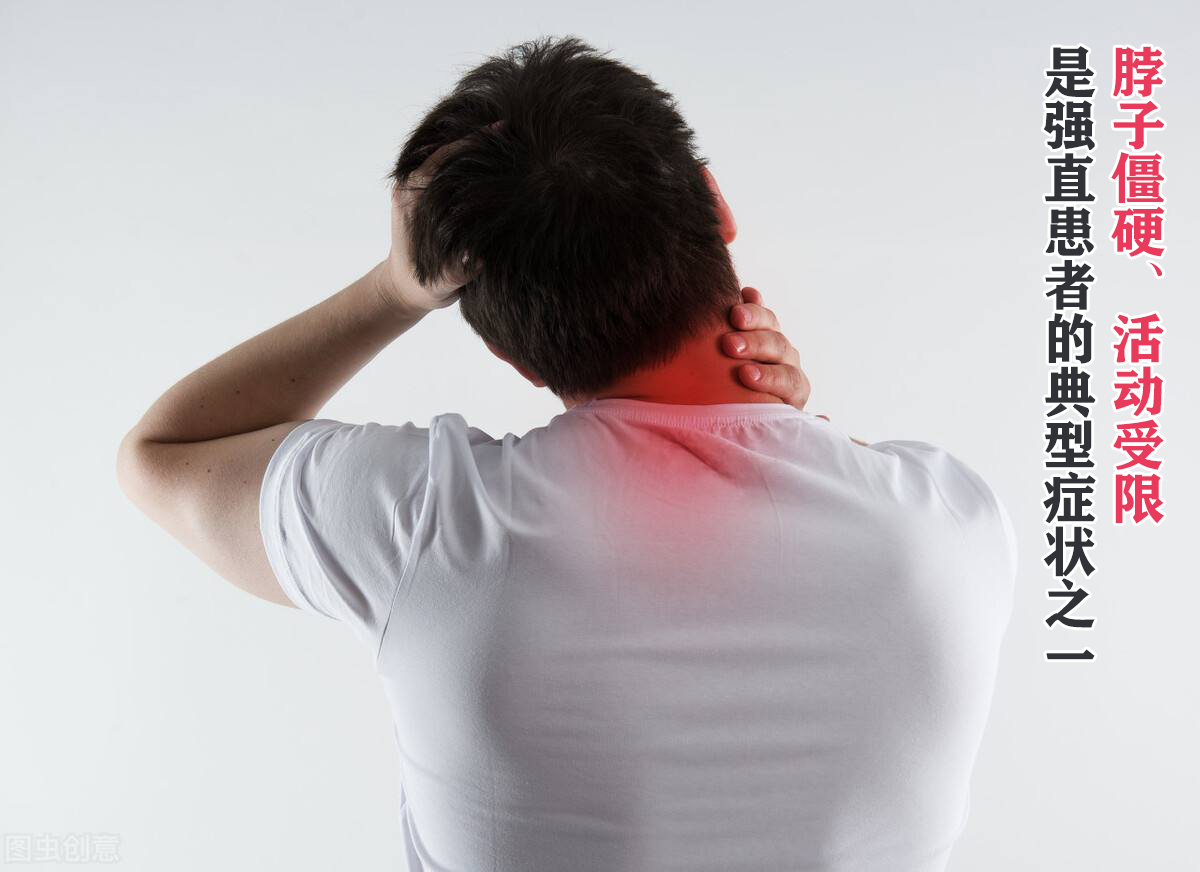 如何判断强直性脊柱炎的严重程度,判断强直性脊柱炎最简单的方法