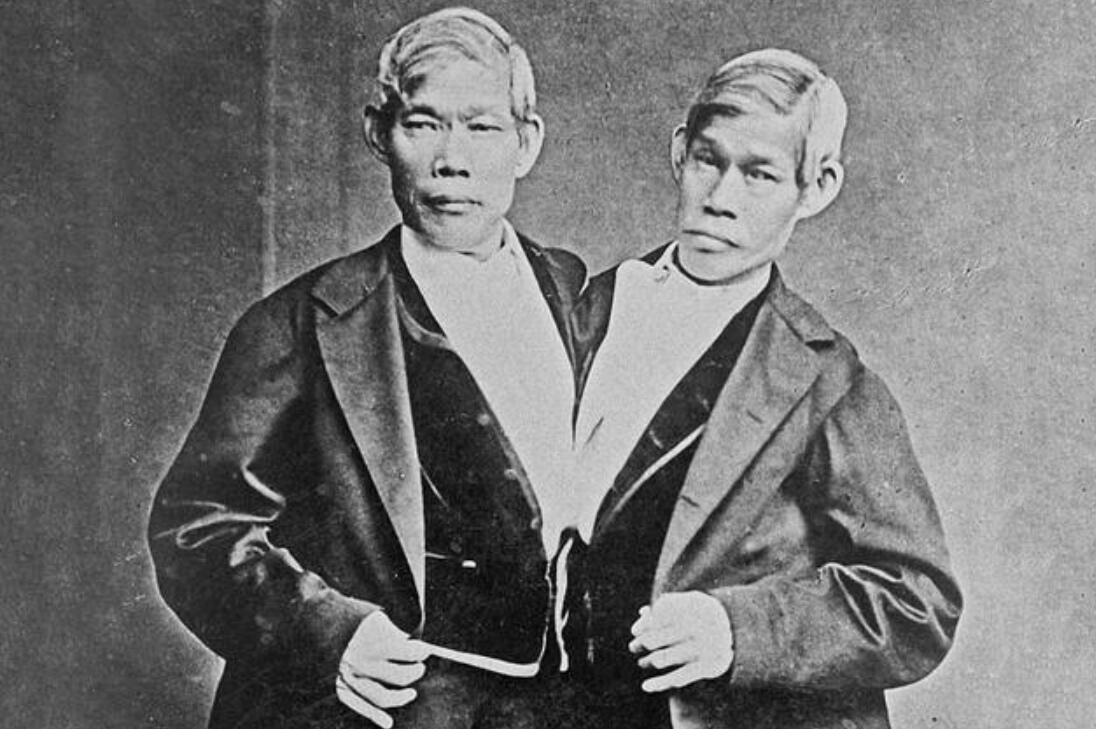 连体人该怎么结婚生子,邦克兄弟连体人