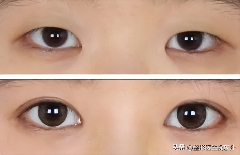 想变漂亮做什么医美,想变漂亮也不要犹豫