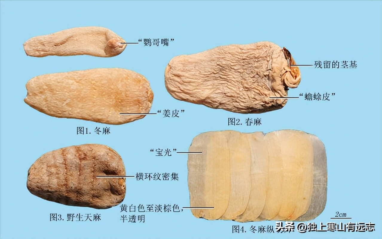 天麻炖什么治疗惊风,天麻为啥可以治小儿惊风癫痫