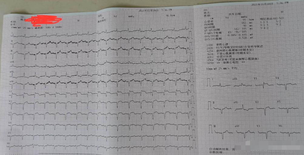 75岁以上老人反复发烧伴有咳嗽,75岁老人感冒咳嗽怎么办