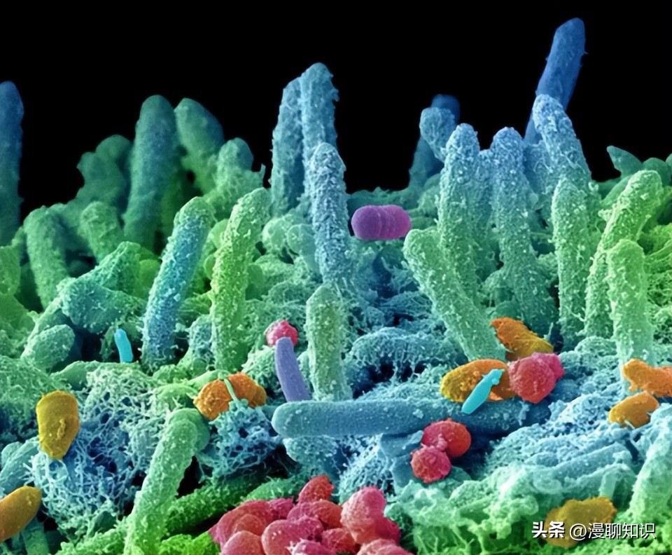 慢性复发性骨髓炎儿童案例,青少年得慢性骨髓炎能治好吗