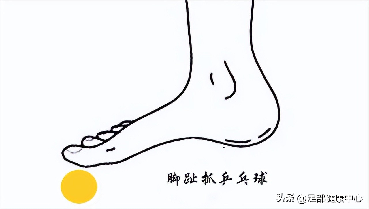 小脚趾往二脚趾方向歪怎么矫正,第三根脚趾头歪斜怎么矫正