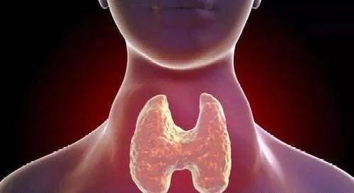 桥本甲状腺炎中医解释,中医对桥本氏甲状腺炎的认识