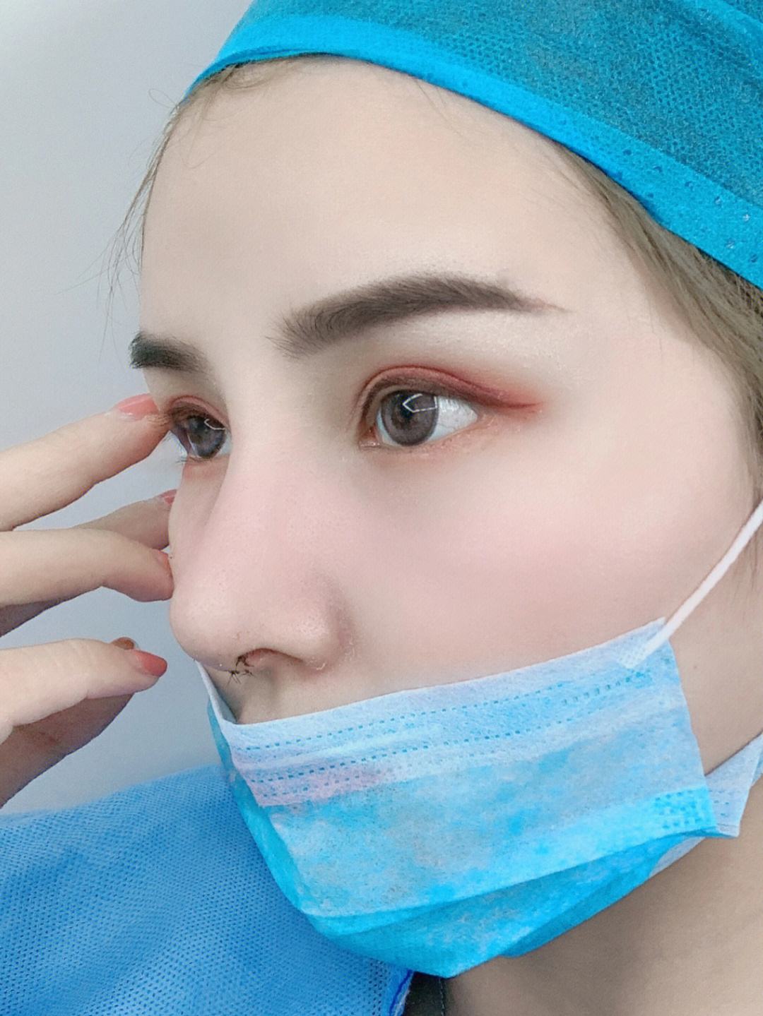 整形手术鼻综合包含哪些项目,鼻整形抖音必火话题