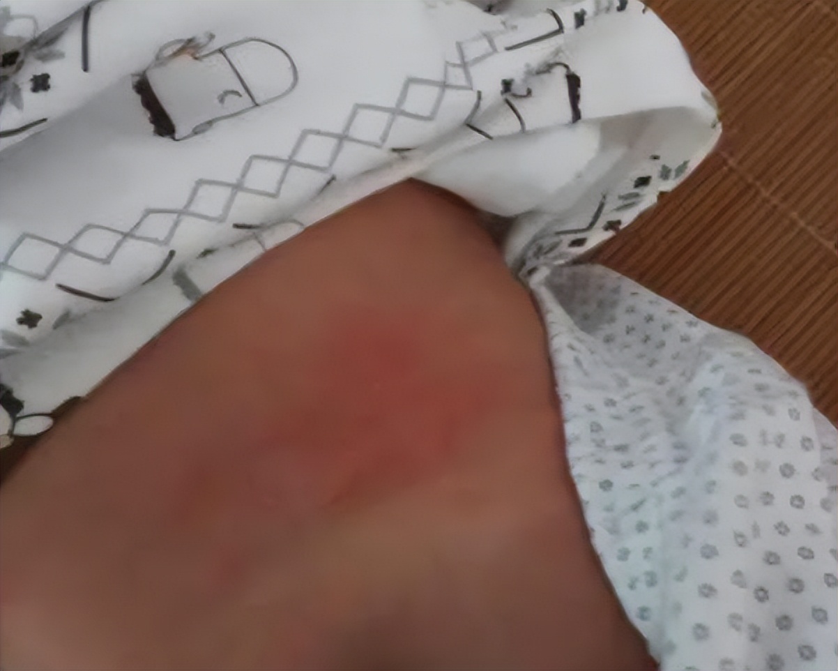 胃火肺火的症状有哪些表现,有胃火和肺火的症状