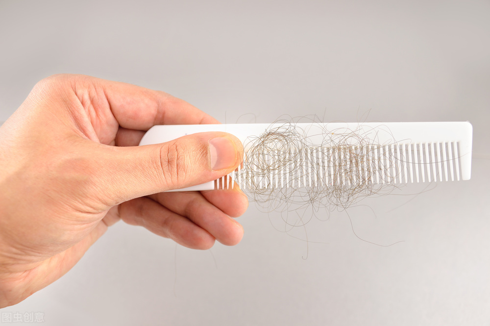 这9种情况告诉你为什么脱发困扰从古至今，有哪些医学方式治疗？