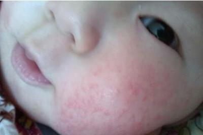 宝宝护肤保暖,宝宝冬季护肤润本