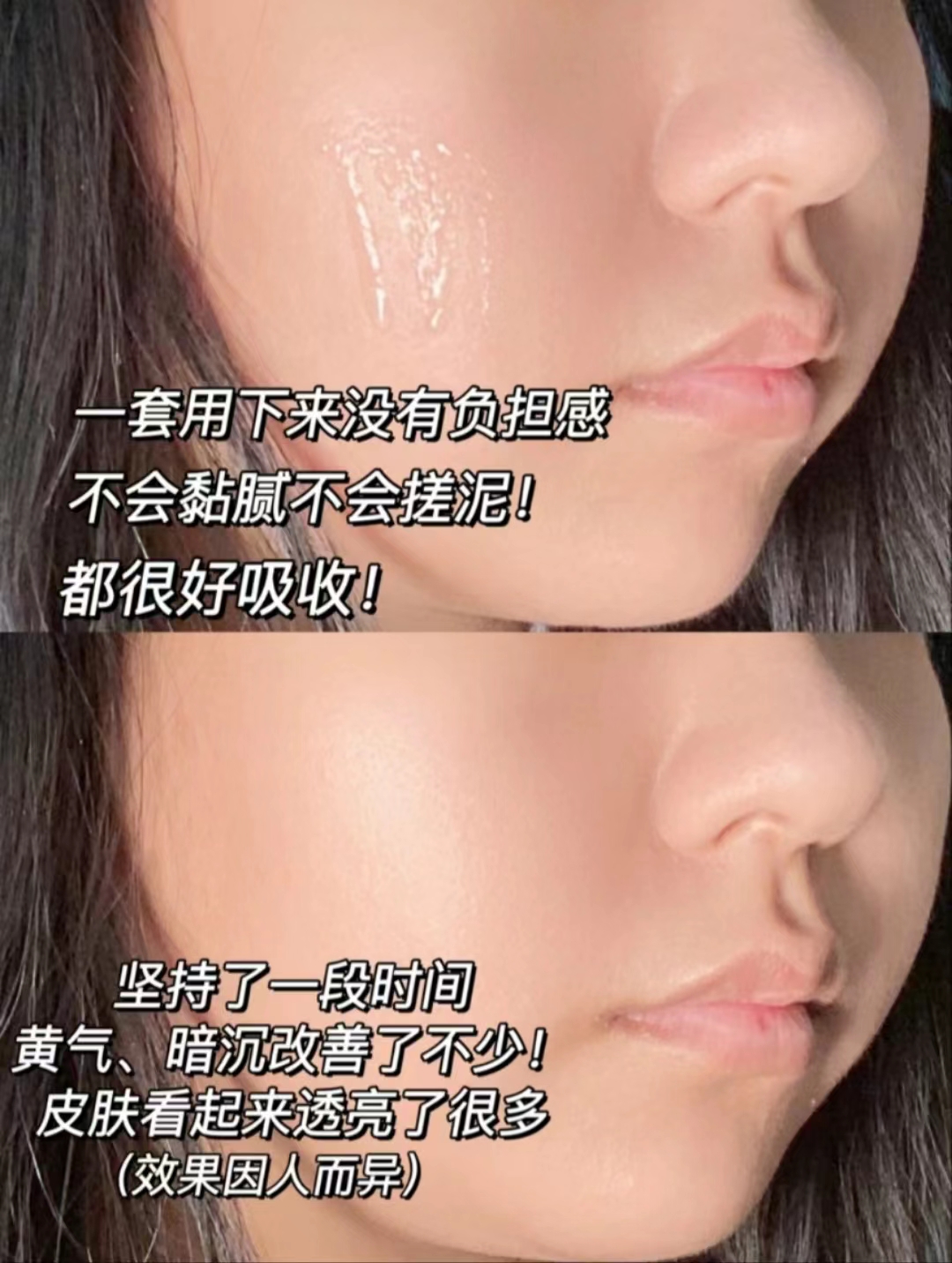 玻尿酸清润补水六件套,春夏玻尿酸高保湿3部曲挚爱套装