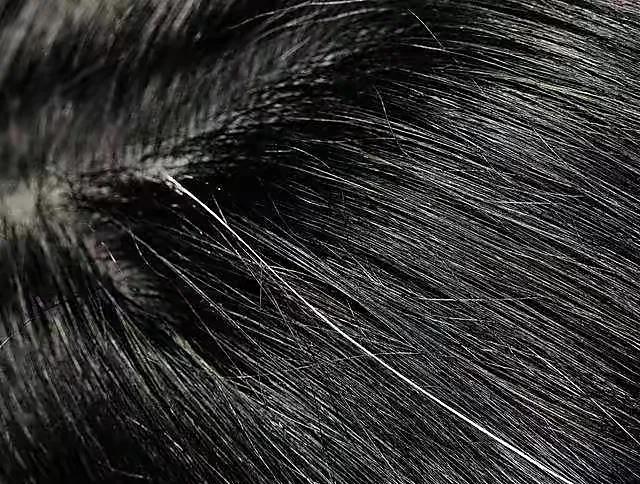 白发越拔越多是有根据的,白发真的会越拔越多嘛