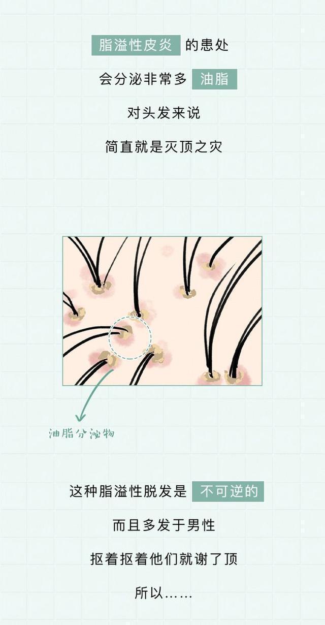 头皮上白色的颗粒是什么问题,头皮屑多是什么原因漫画