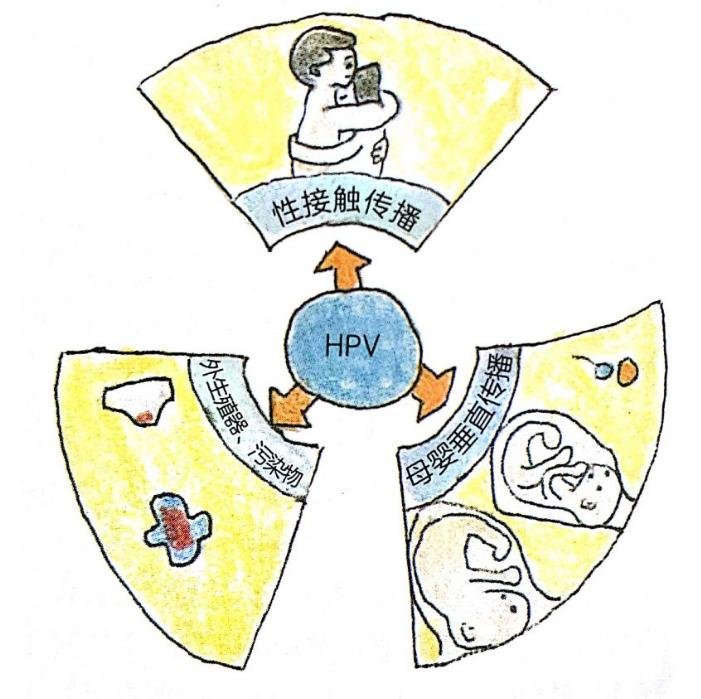 怀孕查出hpv31,怀孕hpv阳性会影响胎儿吗