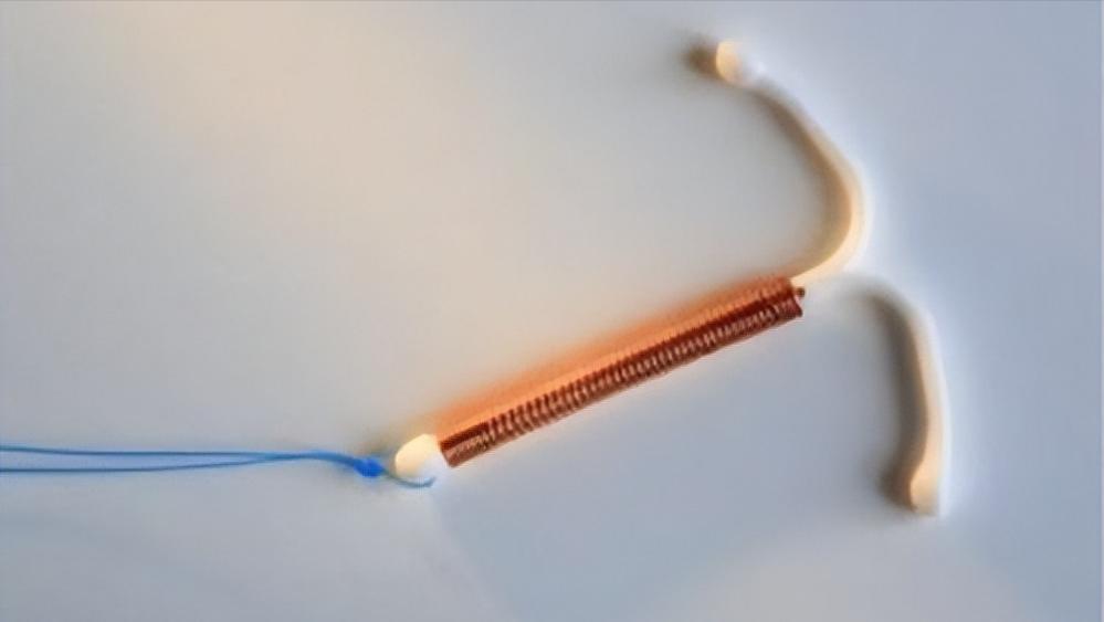 女人身体里的节育环不取出来行吗,女性身体里的节育环