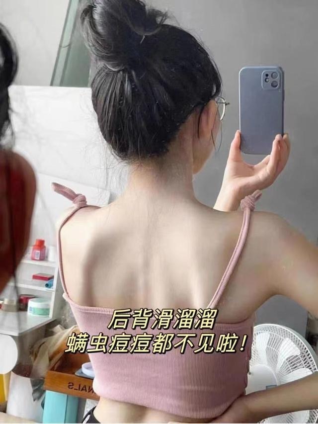 脓包痘消炎祛痘印用什么,祛痘脓包型