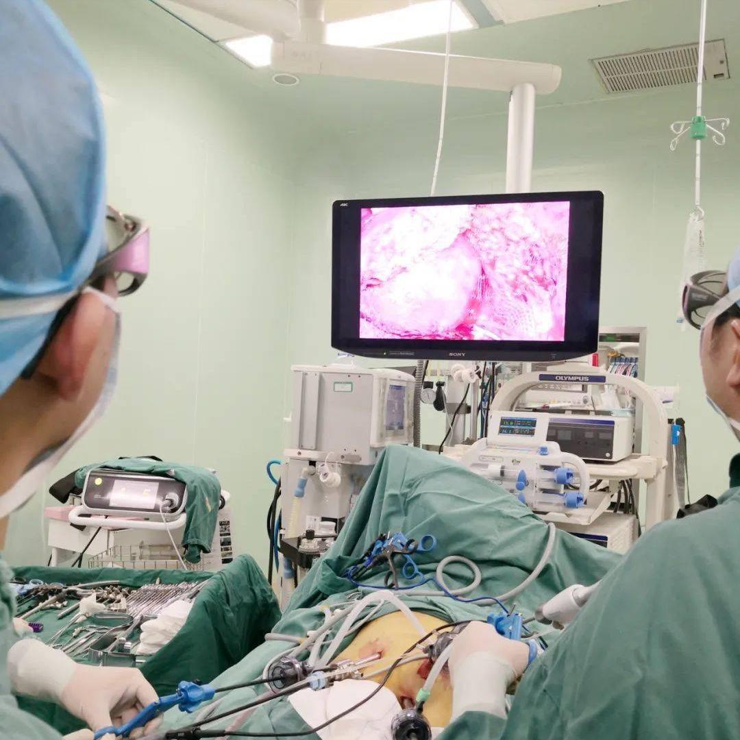 腹腔镜下胆总管切开取石治疗,充填型胆囊结石用腹腔镜怎样切除