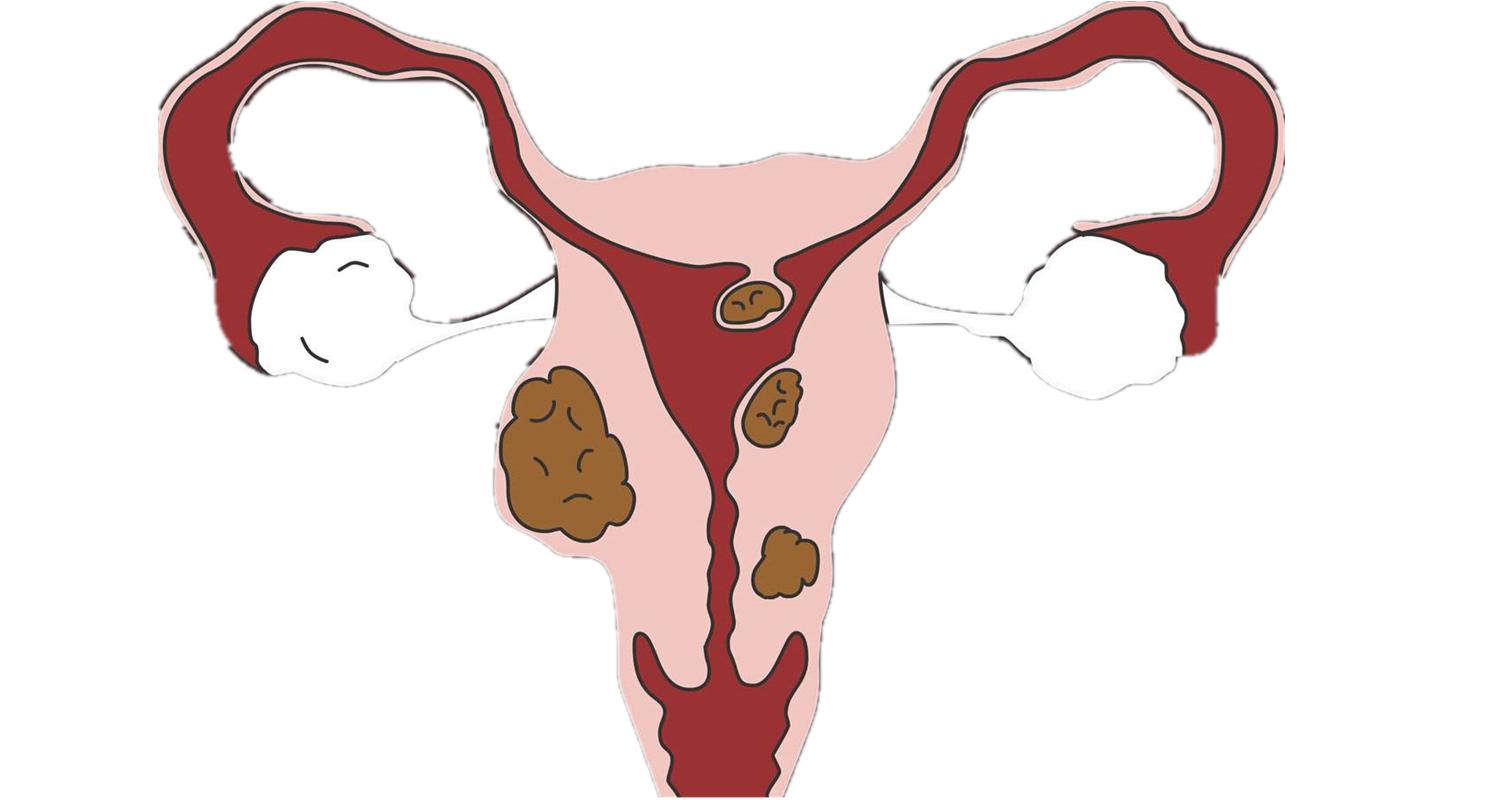 桂枝茯苓丸化瘀功效,桂枝茯苓丸可治这十种病