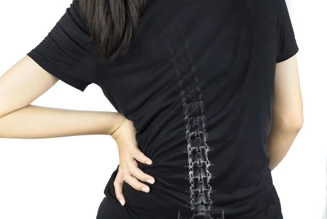 脊柱侧弯站立矫正法,脊柱侧弯自我矫正法站桩