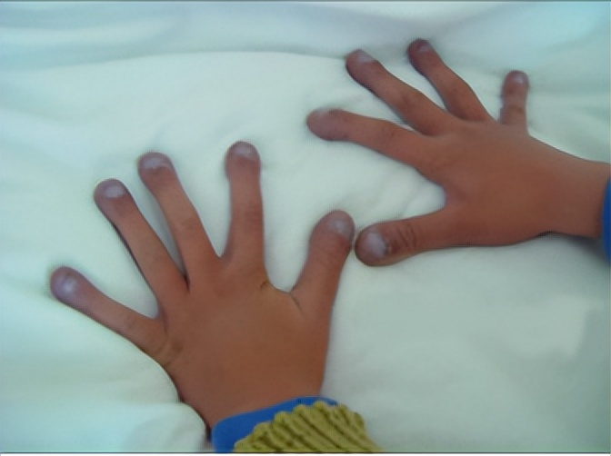 为什么我指甲都变了颜色了,为什么我的指甲是紫色的