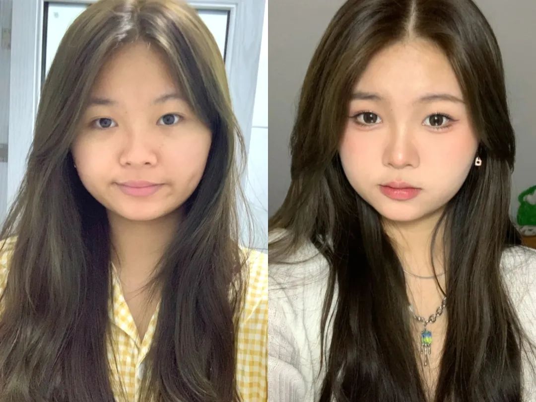 塌鼻子正脸好看,塌鼻子该如何变美啊