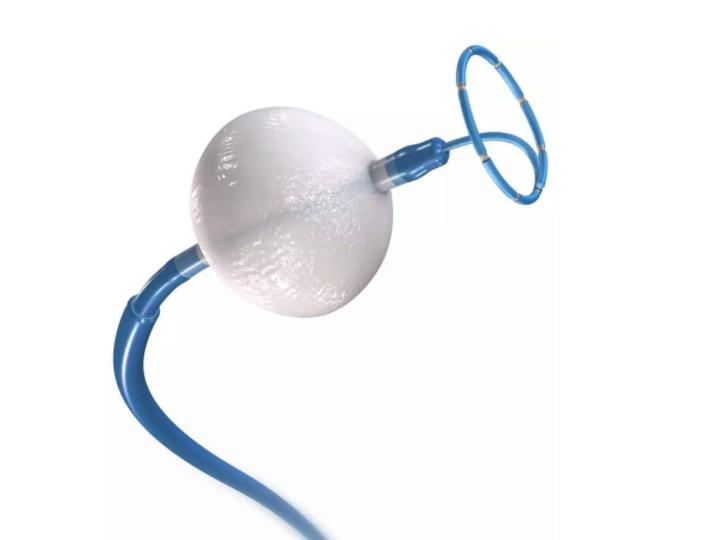 700块的心脏支架和20000块的药物球囊，哪个更好？医生：别误解了