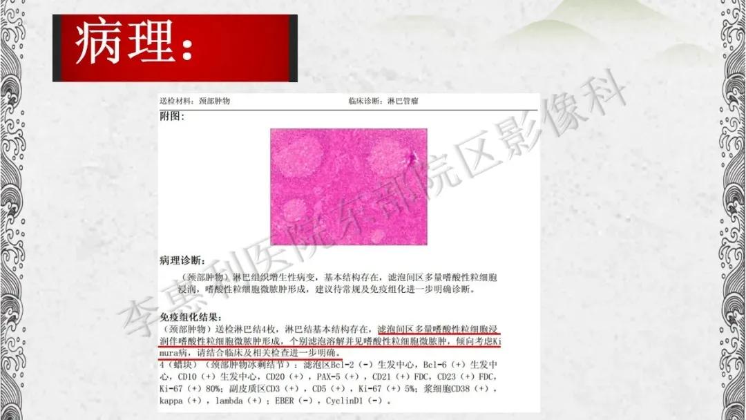 木村病治愈成功案例,木村病诊断案例