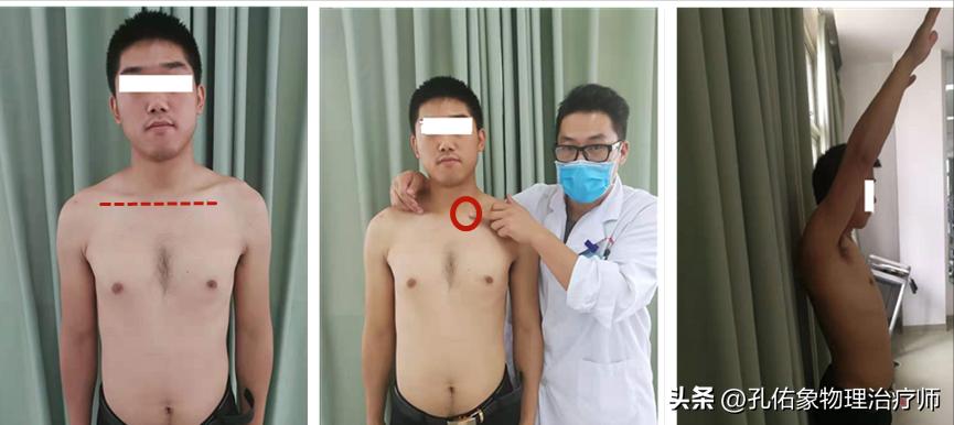 左边肩膀疼痛的治疗方法小妙招,肩膀手往后抬时疼痛是什么原因