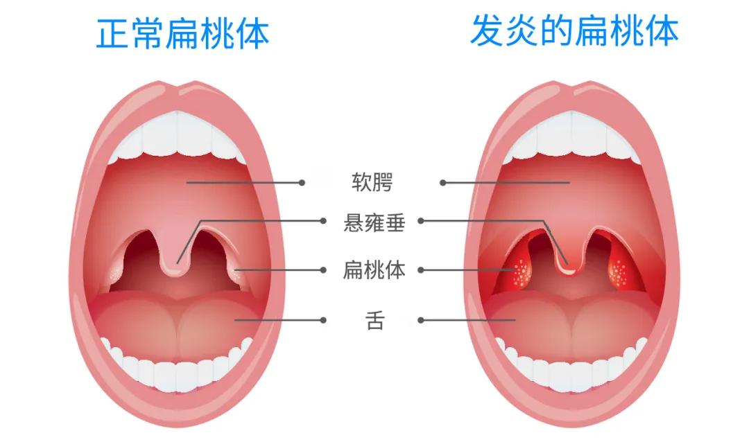吐出黄色的苦东西咋回事,吐出了黄色绿色的苦水是什么
