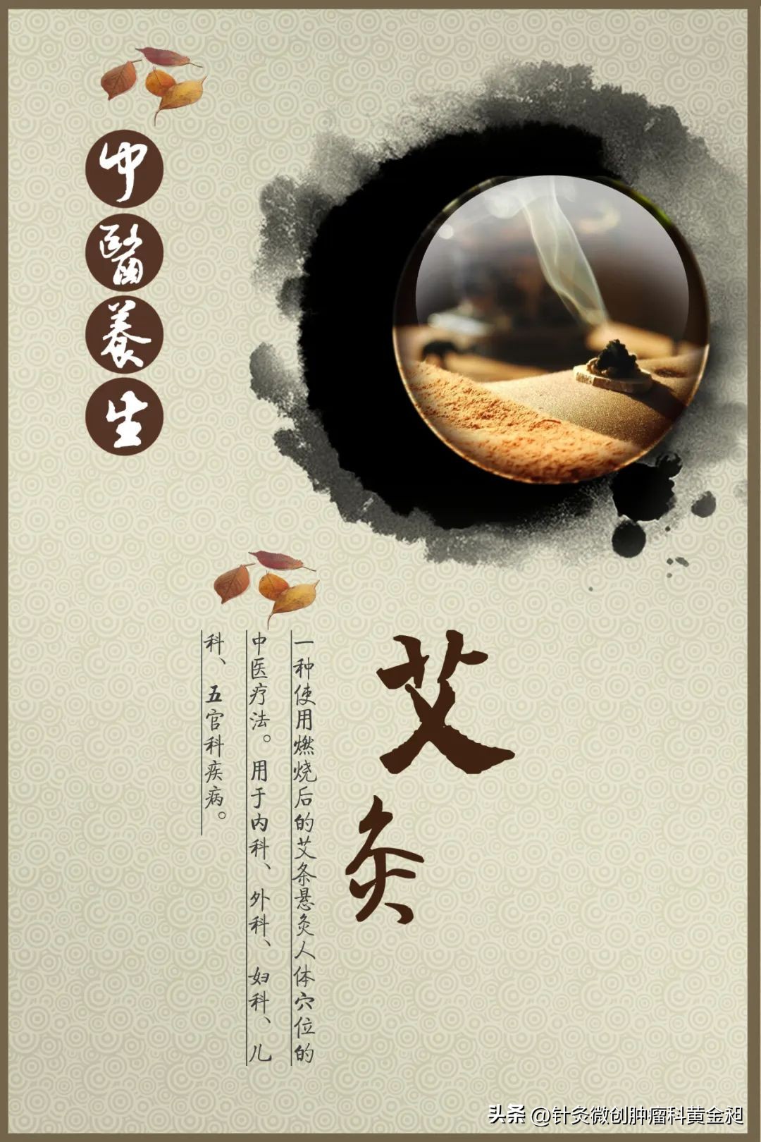 艾灸肿瘤病灶好处,艾灸抗肿瘤的案例