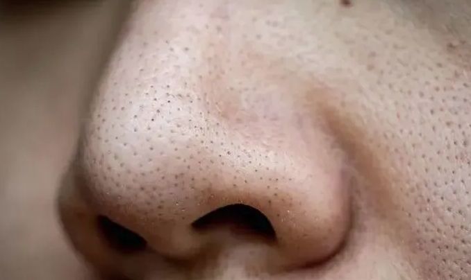 清洁毛孔最有效的方法收缩毛孔,清洁毛孔收缩毛孔用什么方法