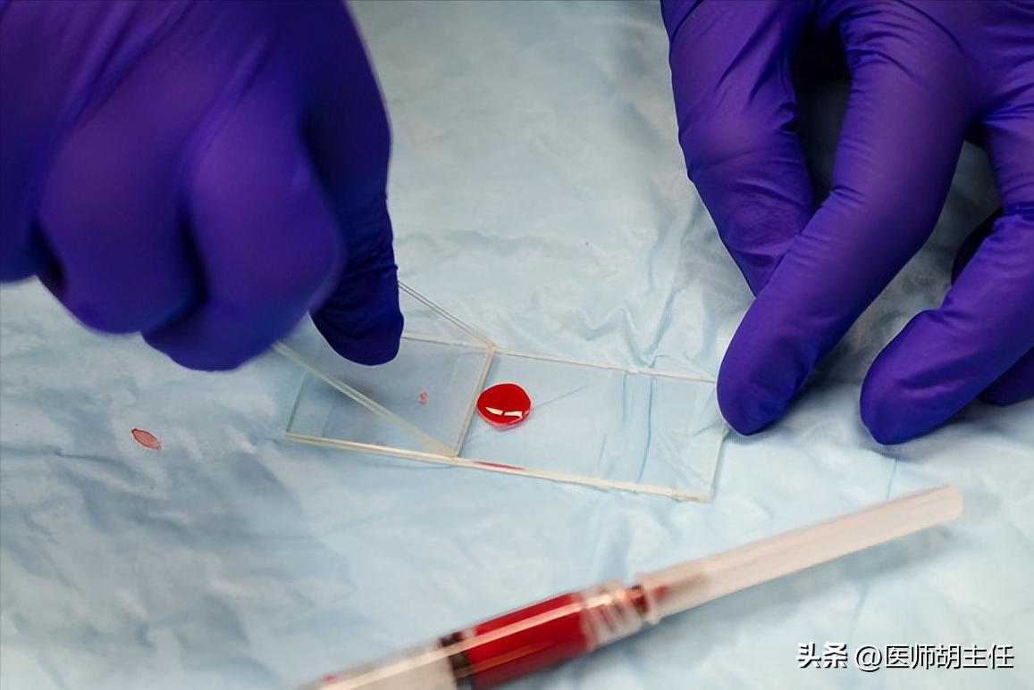 医生坦言：这5个检查项目，花的是冤枉钱，真没必要做