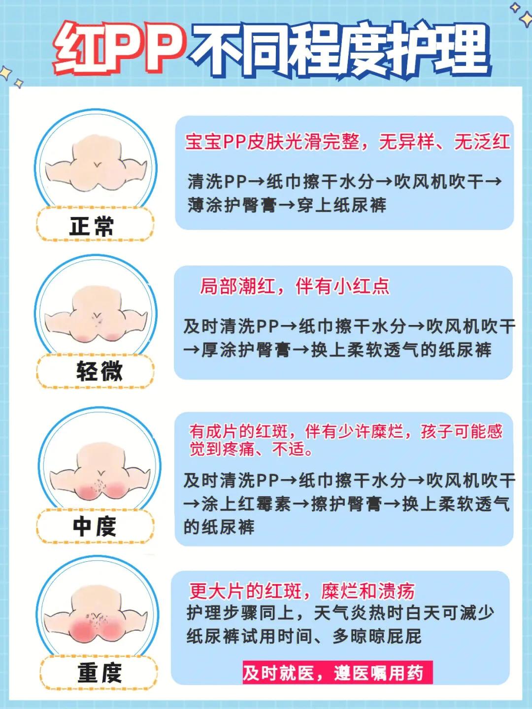 宝宝红pp多久能好,红宝宝家庭教育分享