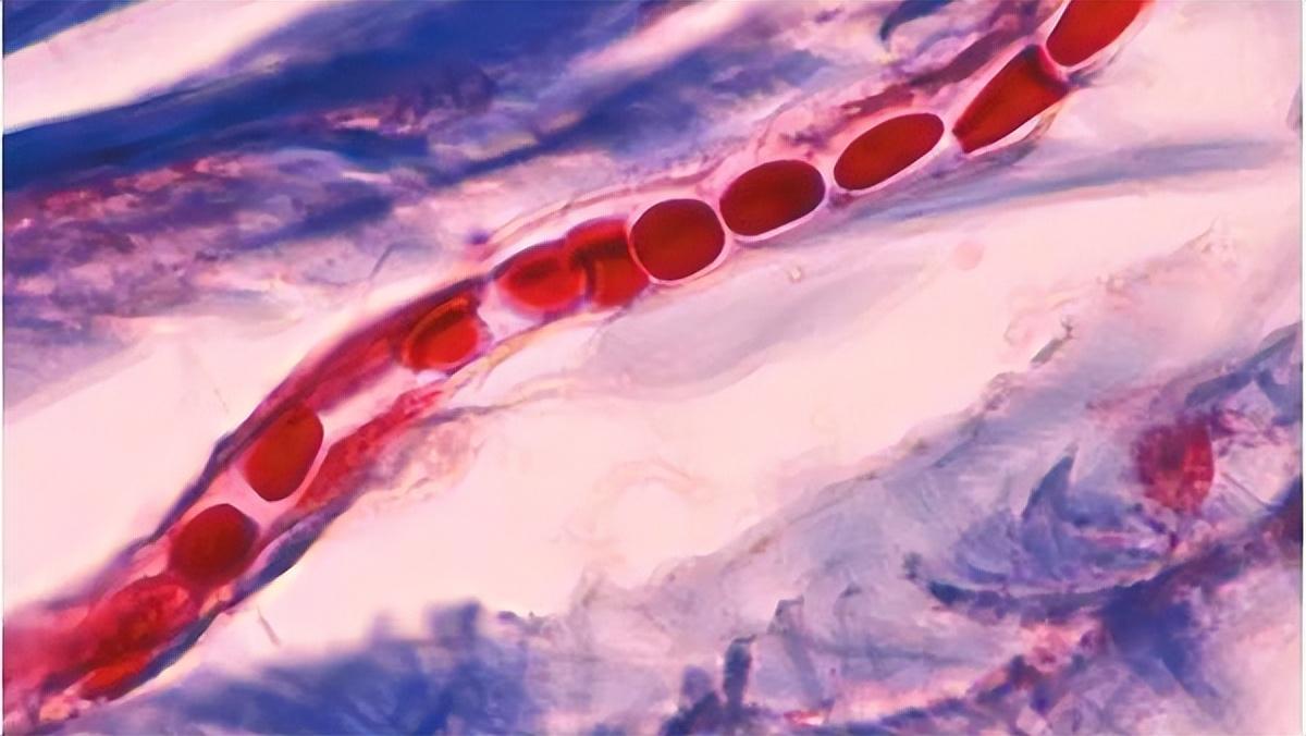 裸睡，真的那么“神奇”吗？医生坦言：裸睡虽好，但这些也要注意