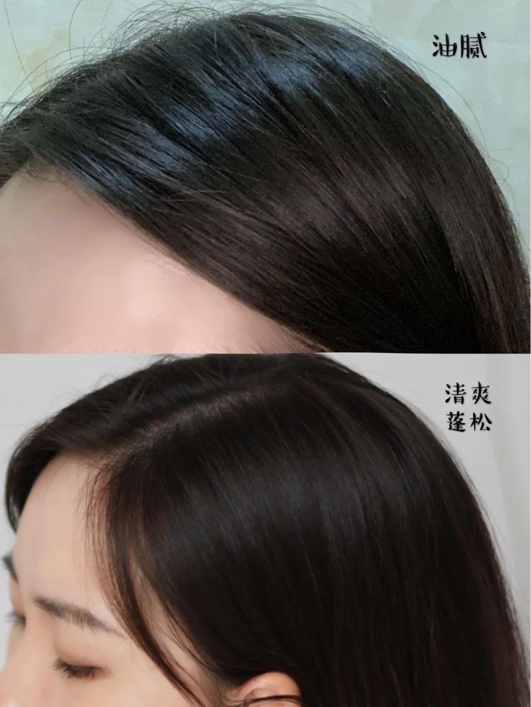 头发油的临时补救措施,五天头发很油咋办