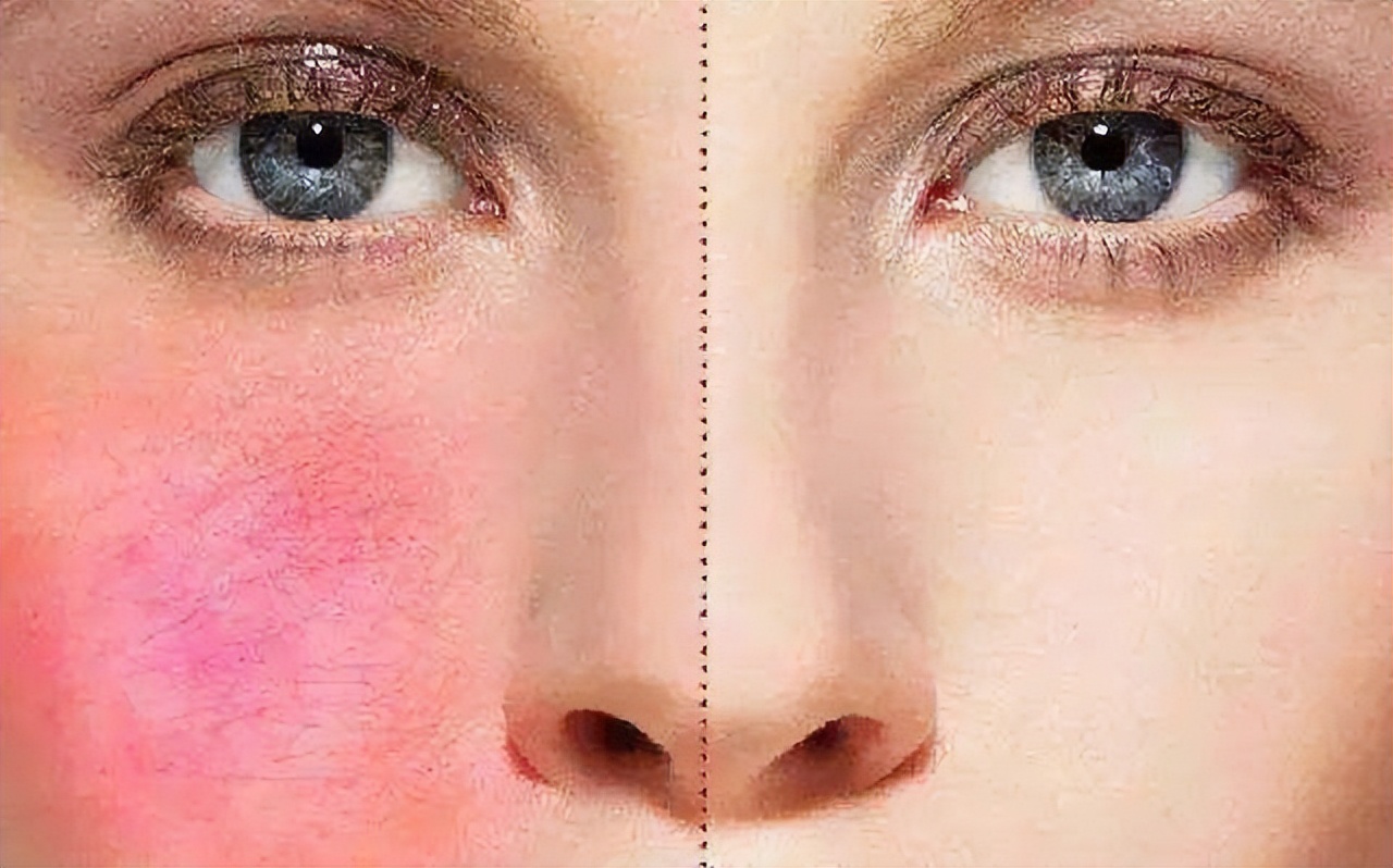 含硫磺洗面奶的功效,含酒精的洗面奶对皮肤有什么伤害