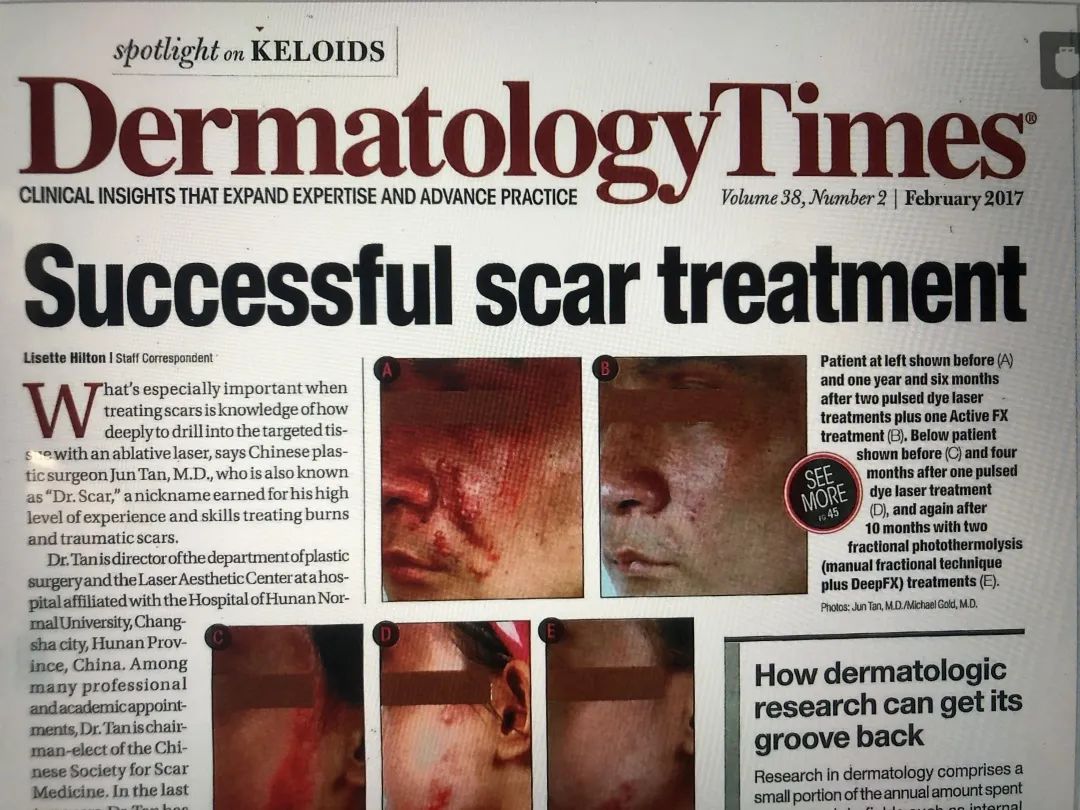 「省医·名医」谭军：让疤痕原位复活的“魔法师”