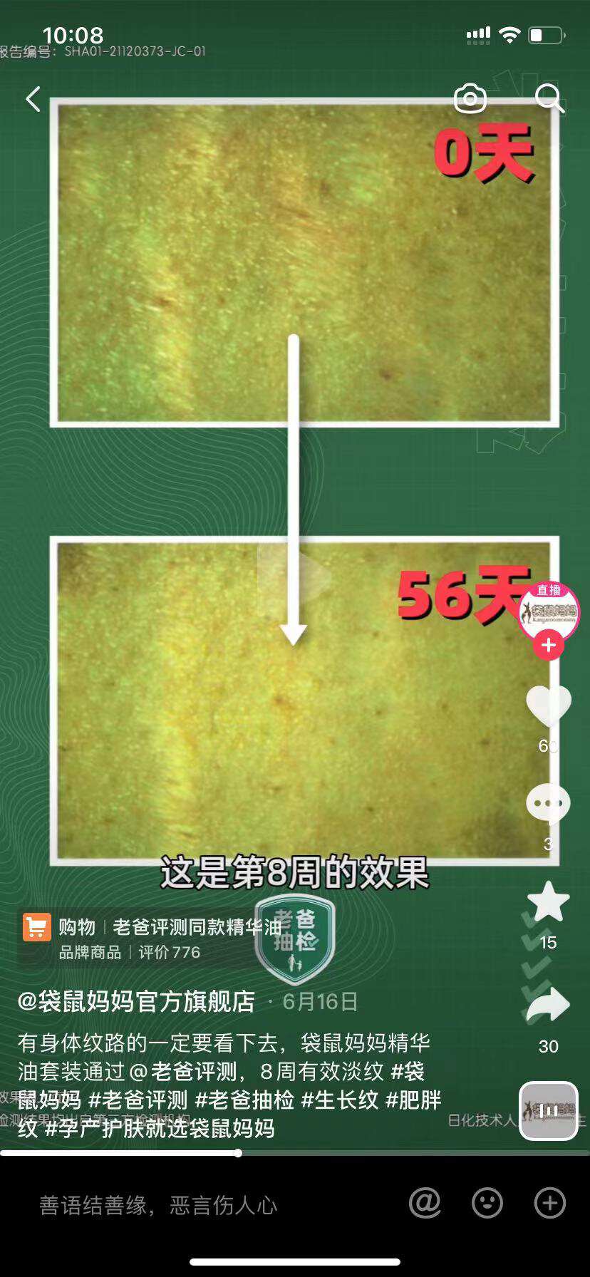 胳膊和大腿上的肥胖纹怎么能消掉,大腿有肥胖纹有十年了还能去掉吗