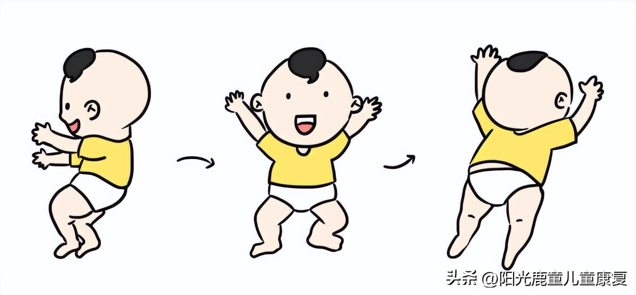 康复运动训练不会走路孩子,宝贝走路康复训练20个动作